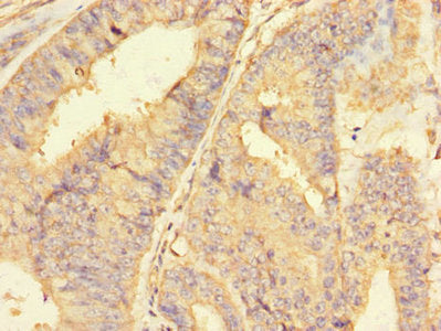 RBBP8 Antibody