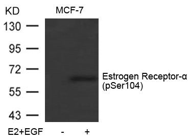 Phospho-ESR1 (Ser104) Antibody