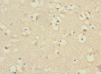 PTPN18 Antibody