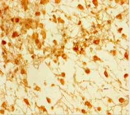 SMAD5 Antibody