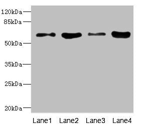 PIP5K1A Antibody