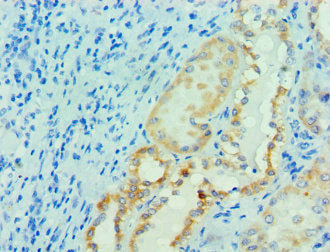 PRMT1 Antibody