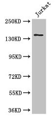 ATXN2 Antibody