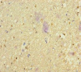 NSMF Antibody