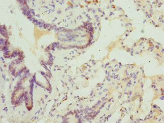 ABCA3 Antibody