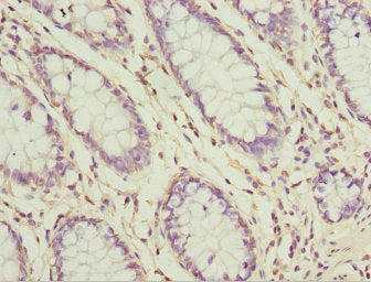SH3GL1 Antibody