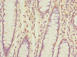 TIMM17A Antibody