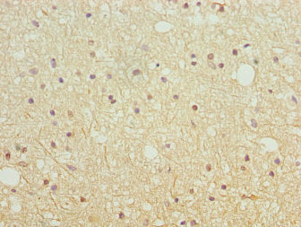 SH3GL2 Antibody