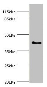 SH3GL2 Antibody