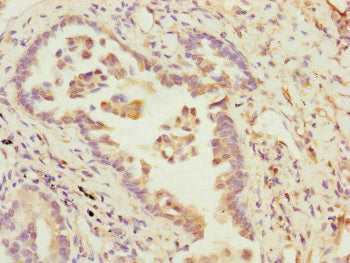 B9D2 Antibody