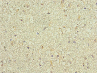 ARPC5 Antibody