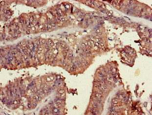 TRIM54 Antibody