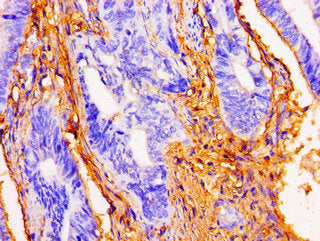 DSG1 Antibody