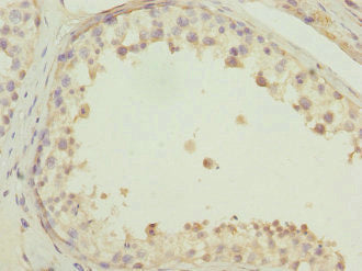 EVA1A Antibody