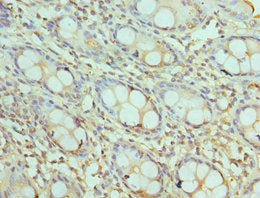 AKTIP Antibody