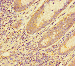 MED20 Antibody