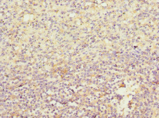 IL21R Antibody