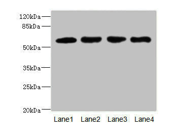 IL21R Antibody