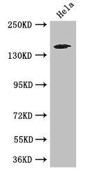 TNRC6C Antibody