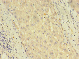 DUSP26 Antibody