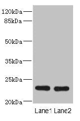 RAB17 Antibody