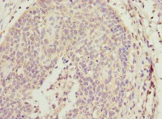 ALG2 Antibody