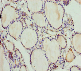 PLEKHA1 Antibody