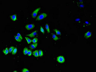 SLC40A1 Antibody