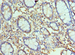 TREX1 Antibody