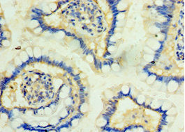 PKD2L1 Antibody