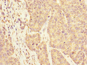 KLHL13 Antibody