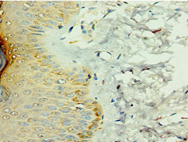 IL36RN Antibody