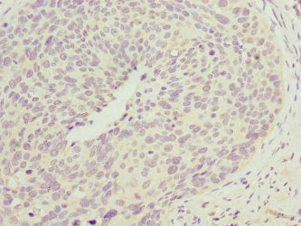 CCM2 Antibody