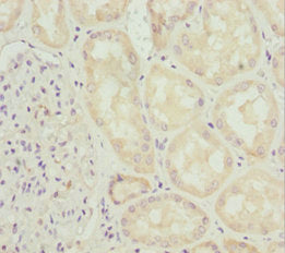 INPP5K Antibody