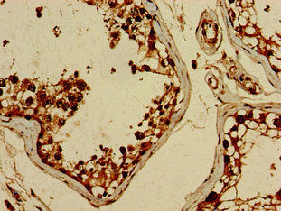 BRIP1 Antibody