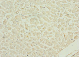 DRAM2 Antibody
