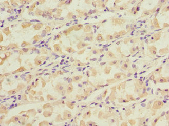 NT5C3A Antibody