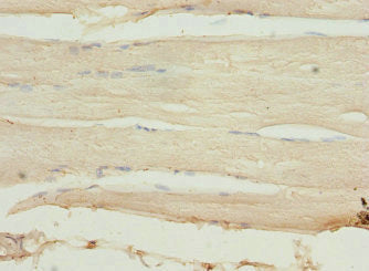 SLK Antibody