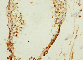 RANBP3 Antibody