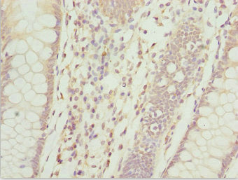 ZFAND3 Antibody