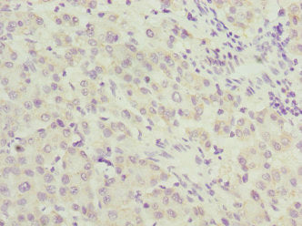 UPF2 Antibody