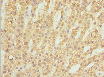 ZBTB20 Antibody