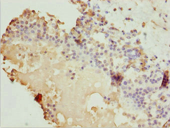 ZBTB20 Antibody