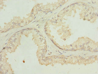 SH3GLB2 Antibody
