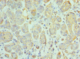 CCL28 Antibody