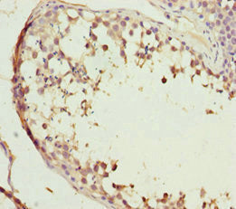 ABCB8 Antibody