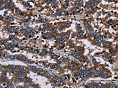 F11R Antibody