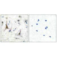 UCHL1 Antibody