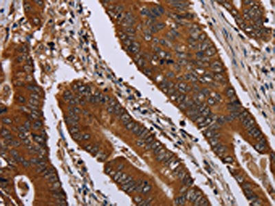 JUP Antibody