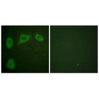 CAV1 Antibody